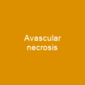 Avascular necrosis