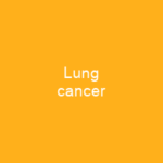 Lung cancer